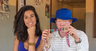 Gioseppo y la Fundación Esperanza Pertusa luchan por la integración de personas con albinismo